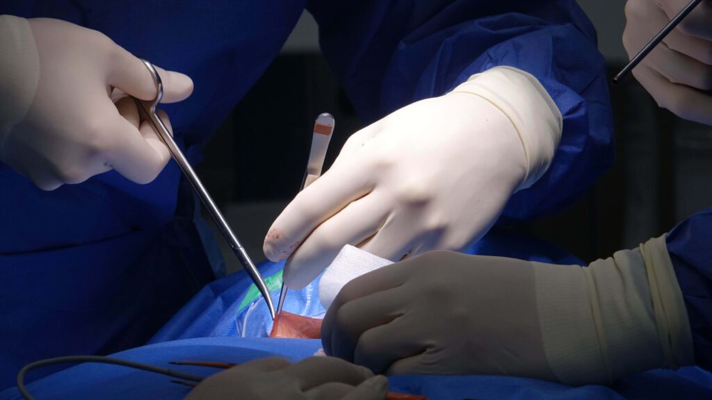 NHS vs Private Adult Circumcision