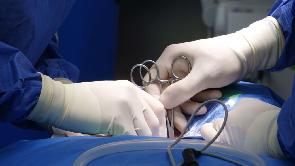 Circumcision and Frenuloplasty together